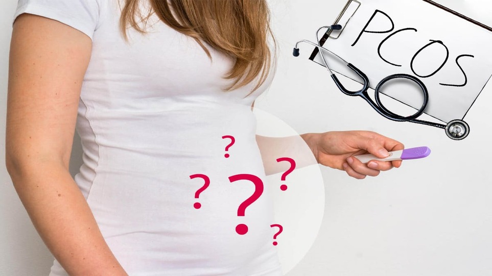 سندرم تخمدان پلی کیستیک و بارداری